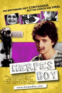 «Herpes Boy»