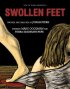 Постер «Swollen Feet»