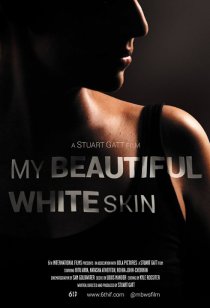 «My Beautiful White Skin»