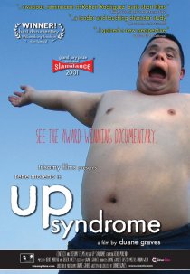 «Up Syndrome»