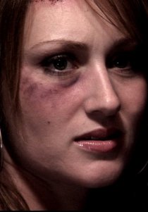 «The Accident»