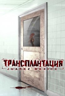 «Трансплантация»