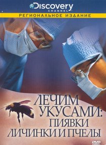 «Discovery: Лечим укусами. Пиявки, личинки и пчелы»
