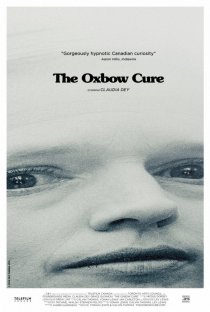 «The Oxbow Cure»