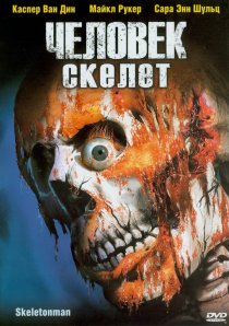 «Человек-скелет»