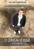 Постер «Аутизм: Мозг Юго»