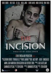 «The Incision»