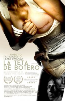 «La teta de Botero»
